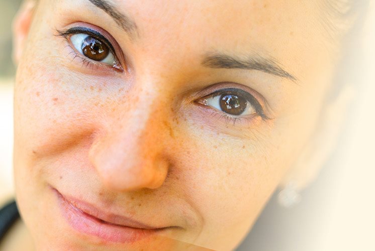 cosa significa comedogeno