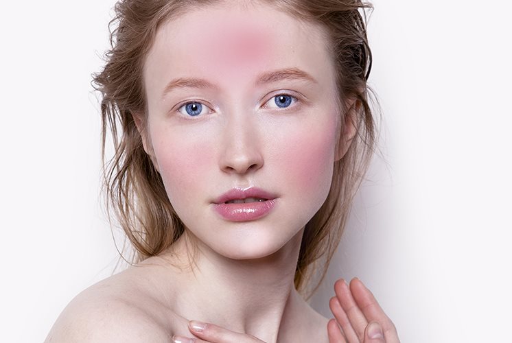 Pelle del viso irritata